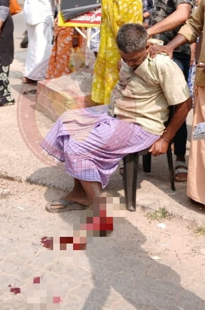 യാത്രക്കാരൻ്റെ കാലിൽ കെ.എസ്.ആർ.ടി.സി. ബസ് കയറി